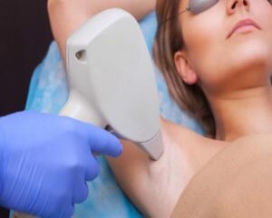 Laser Hair Removal in Hermosa Beach
